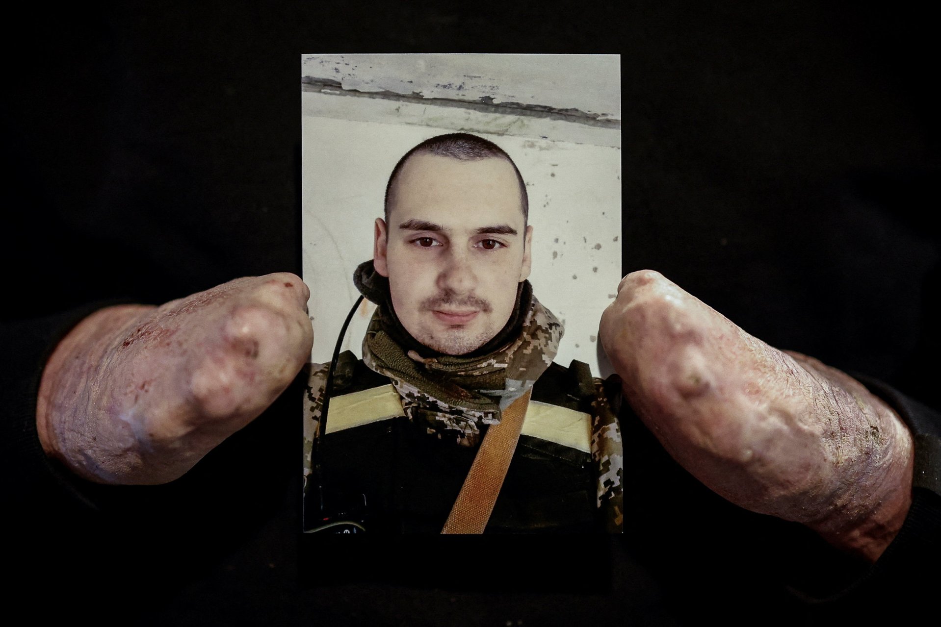 Егор Бабенко держит свое селфи, сделанное до ранения. Сейчас он работает психологом в реабилитационном центре «Титановые». Киев, 21 января 2026 года