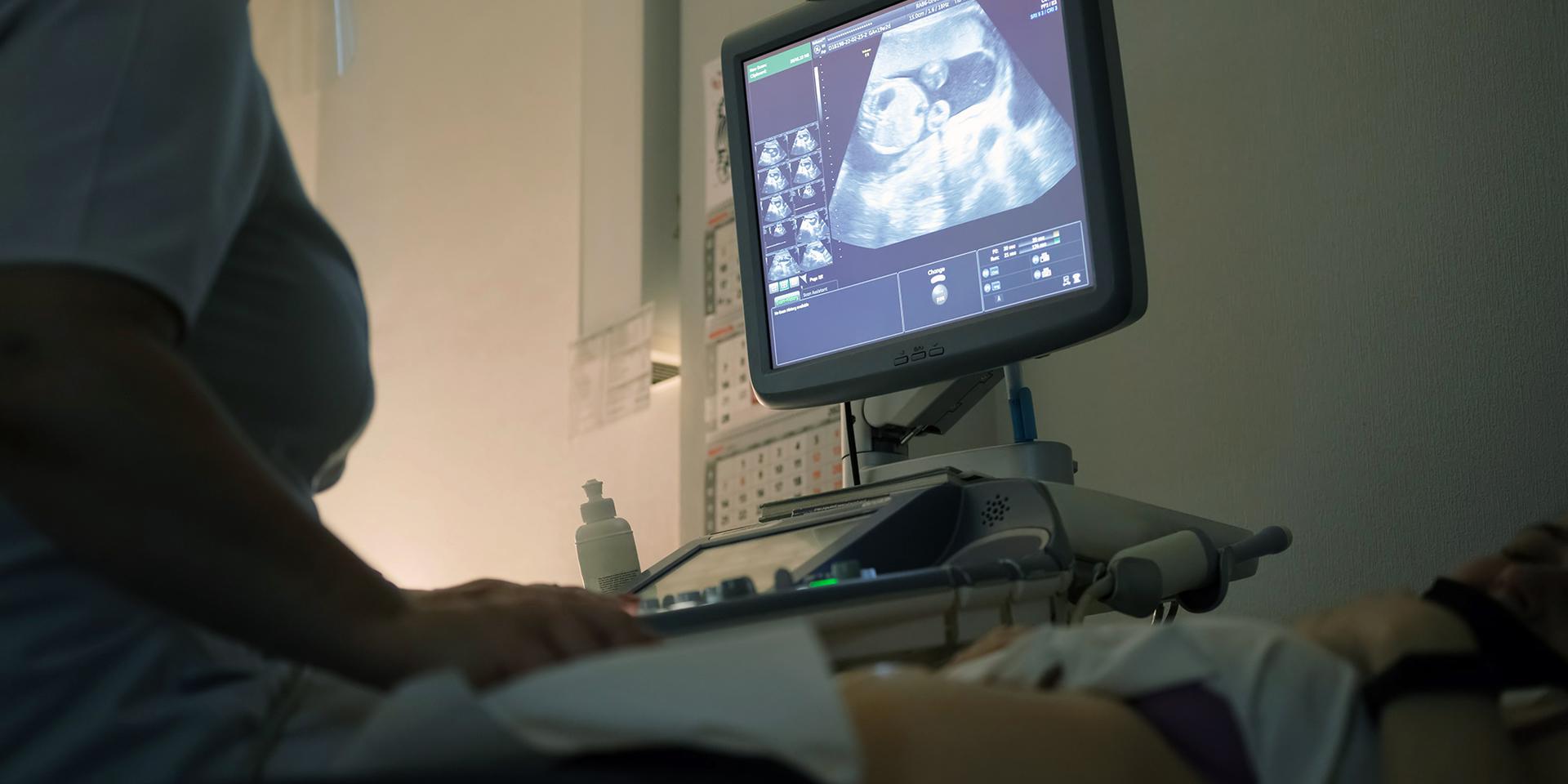 Если в России запретить аборты, будут ли женщины больше рожать?